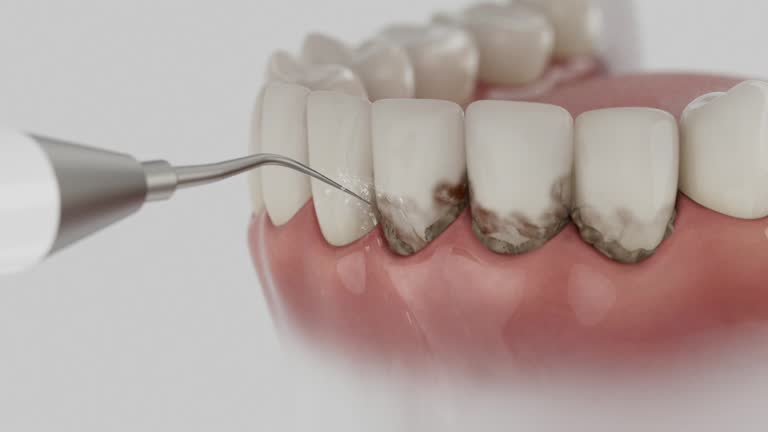 Trusted Teeth Cleaning And Checkup service in Tice, FL - Dentist Open Now